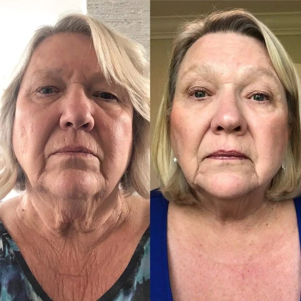 Crema lifting anti-età Gua Sha | Veiggara