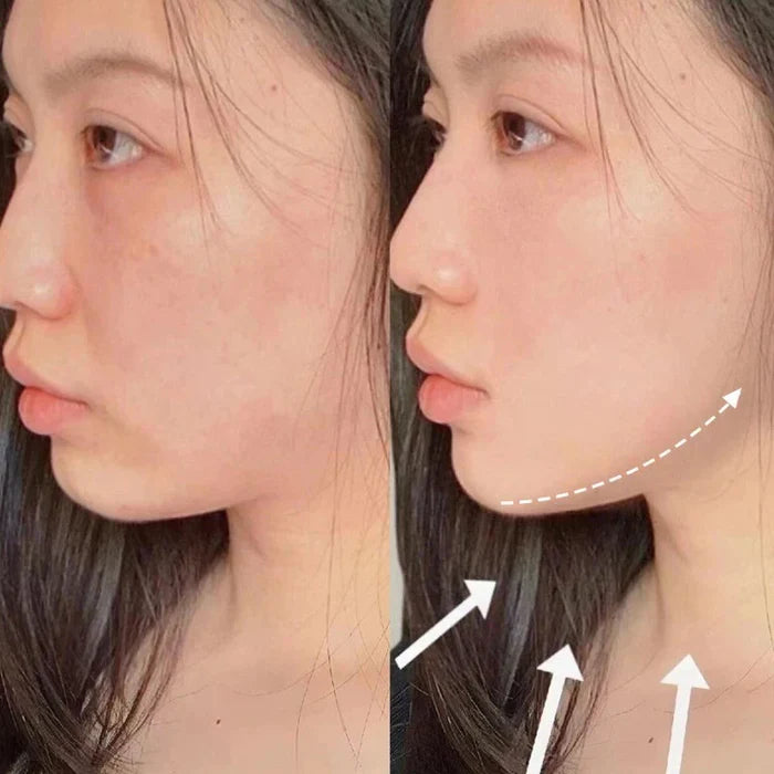 V-Revita™ - Maschera viso per ridurre il doppio mento e le rughe | Veiggara