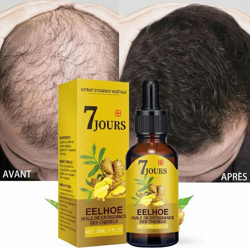 Ginger Hair | Huile pour la croissance des cheveux et le traitement de la calvitie | Veiggara