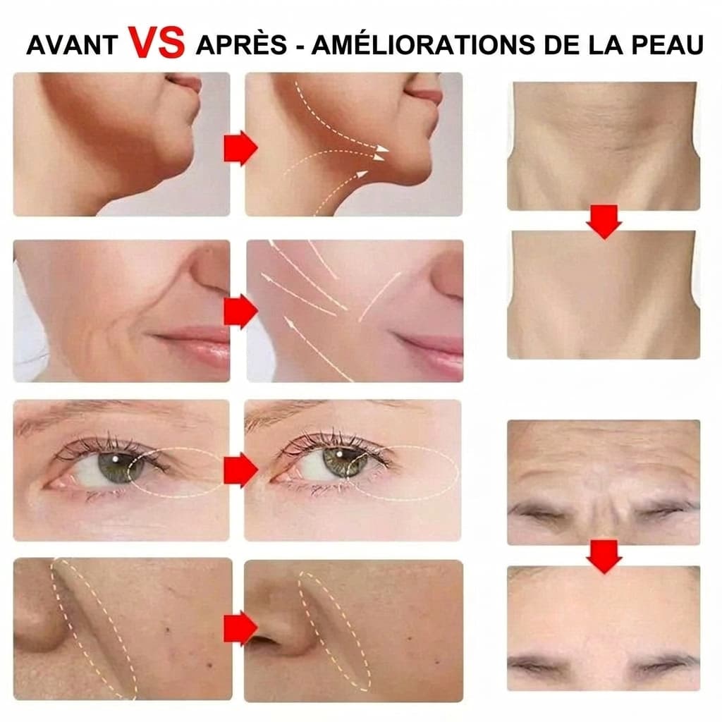 UltraSkin Lift™ Dispositivo portatile a ultrasuoni HIFU - VEIGGARA