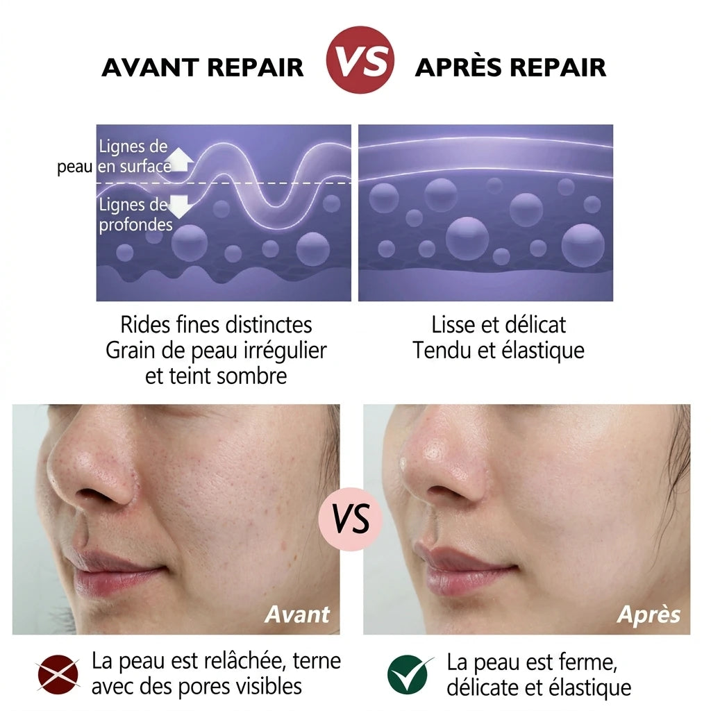 Crema antietà al retinolo [Acquistane 2, ricevine 3] - Veiggara