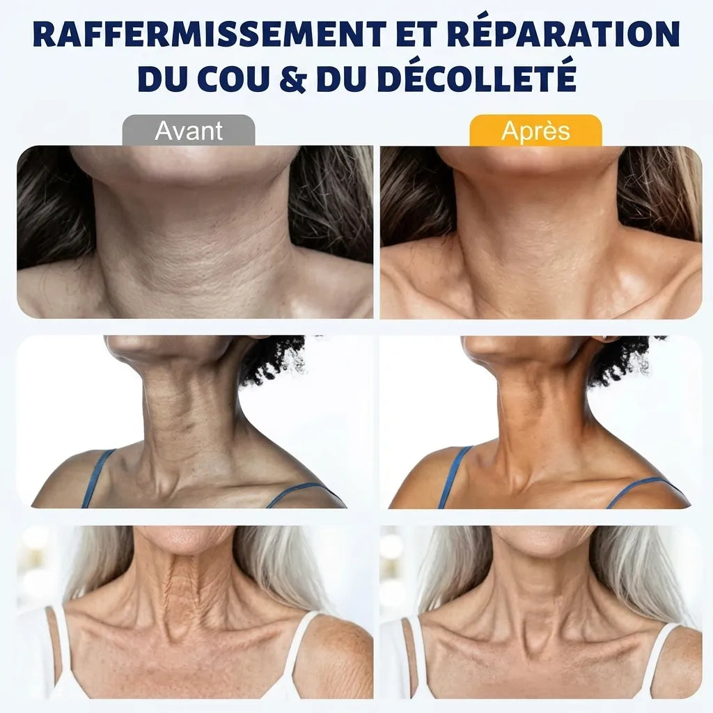 FirmSkin Neck™ - Crème pour le cou au collagène et à l'acide hyaluronique | Veiggara.
